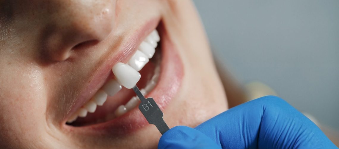 dentist-whiting-teeth