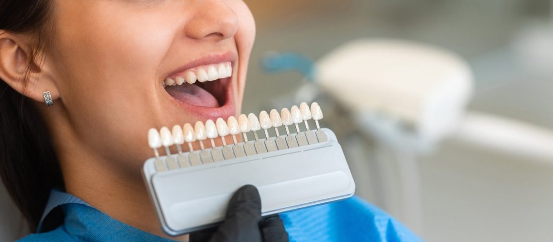 A beautiful young patient uses a dental tooth shade guide for whitening teeth service to ensure a perfect choice of color. Bleaching, prosthetics, orthopedic dentistry concept.